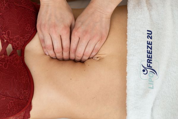 diastasis recti treatment Wembley Park