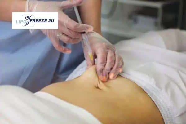 Fat Dissolving Injections Wembley Park & Weight loss medication