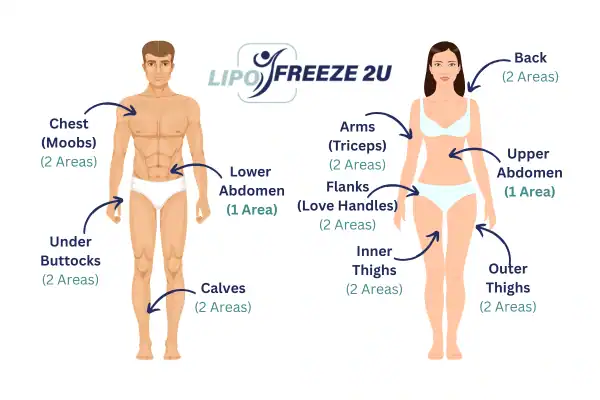 Areas you can have fat freezing treatment Wembley Park
