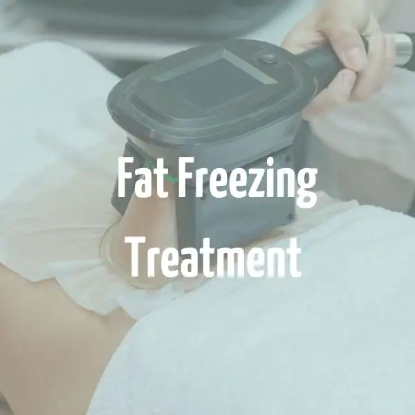 fat freezing treatment Wembley Park