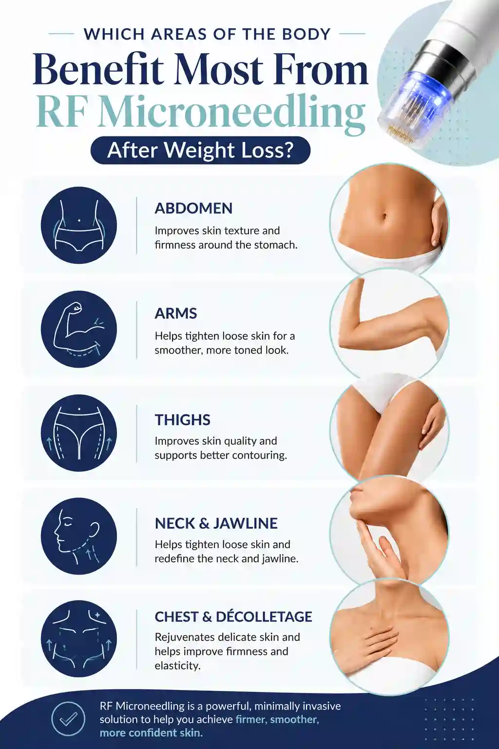 Which Areas of the Body Benefit Most From RF Microneedling After Weight Loss Wembley Park